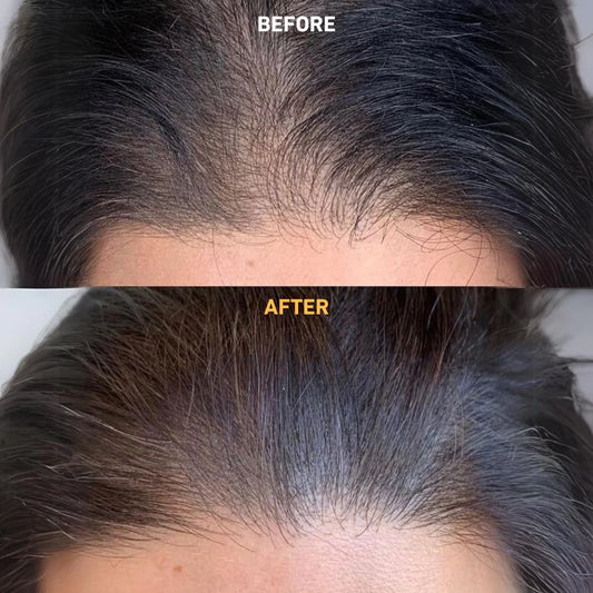 Hair Growth_NAMiTA